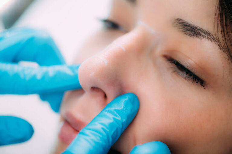 Rhinoplasty in Dubai